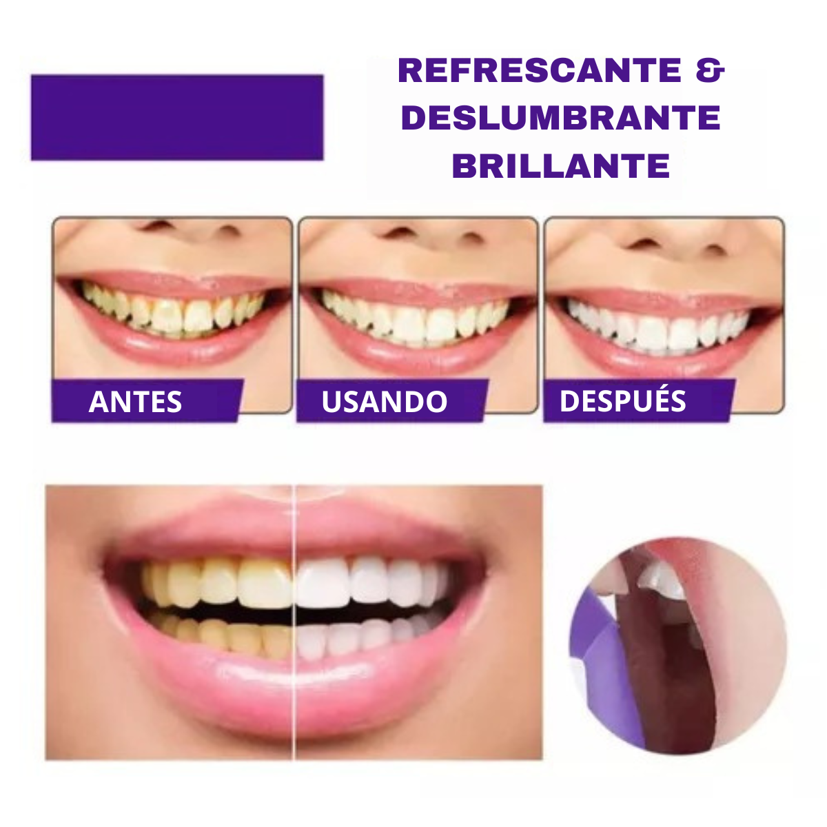 Blanqueador Dental Morada v34